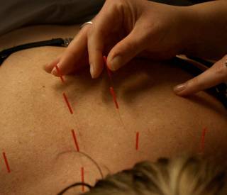 Glossary-Acupuncture-YO1.jpg